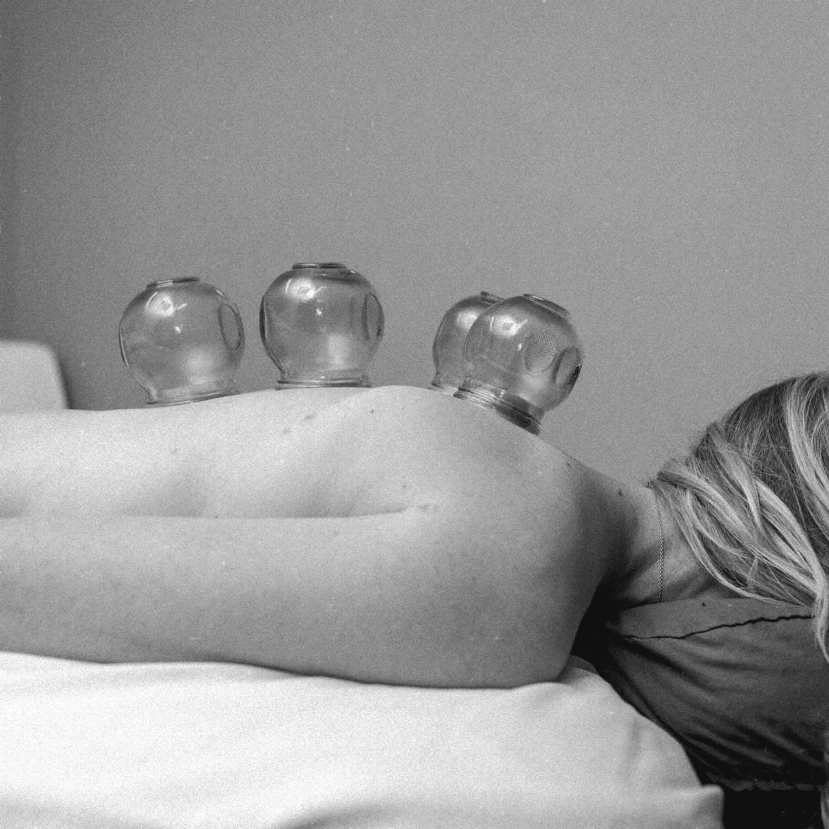 Traditional fire cupping 🔥
90min 125.00
60min 100.00
Breaks-up adhesions and ⬆️ blood flow
A great option for specific areas of tightness or restricted range of motion.
Solamassage.com to book