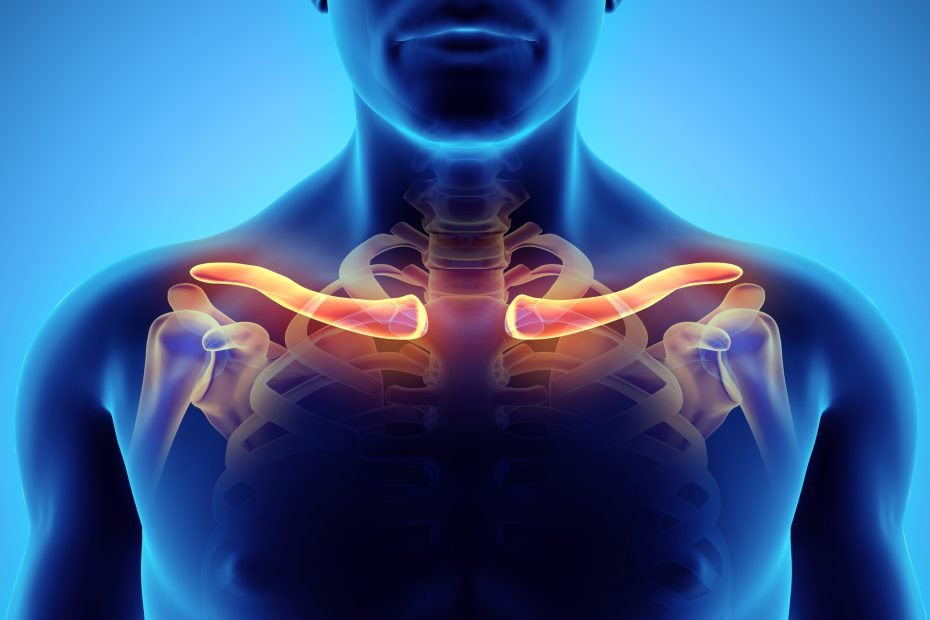 Thoracic Outlet Syndrome: Causes, Symptoms, and Treatment Options