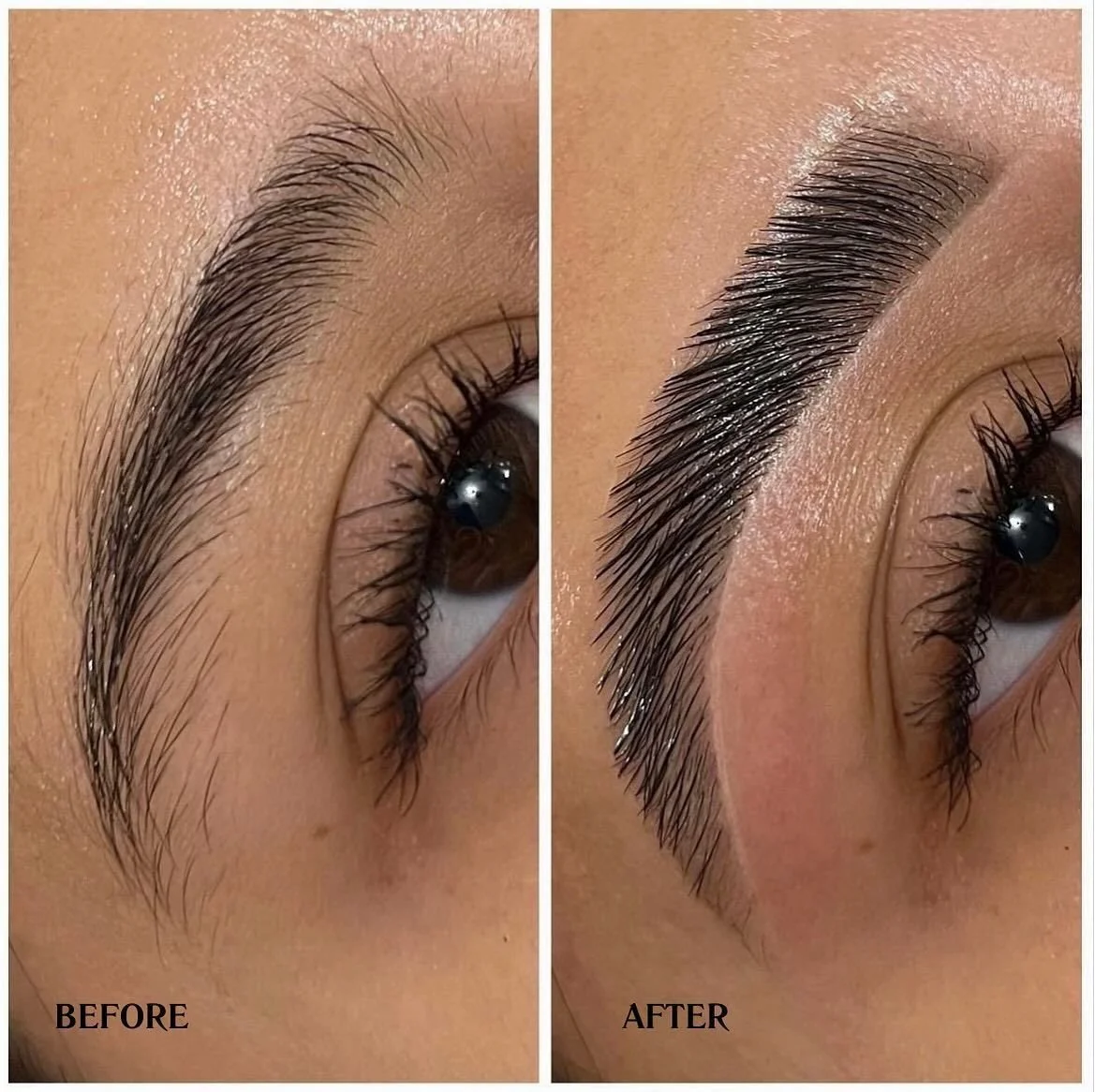 brow-before-after.jpeg