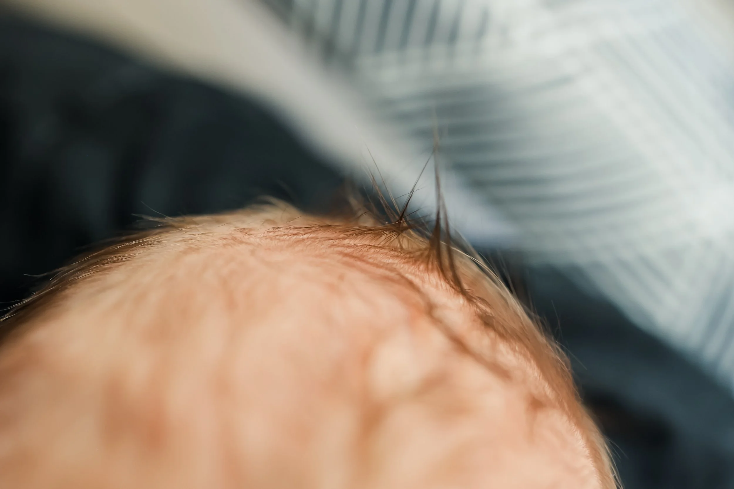 Close-up of a person's forehead and hairline, with short brown hair and visible skin texture.
