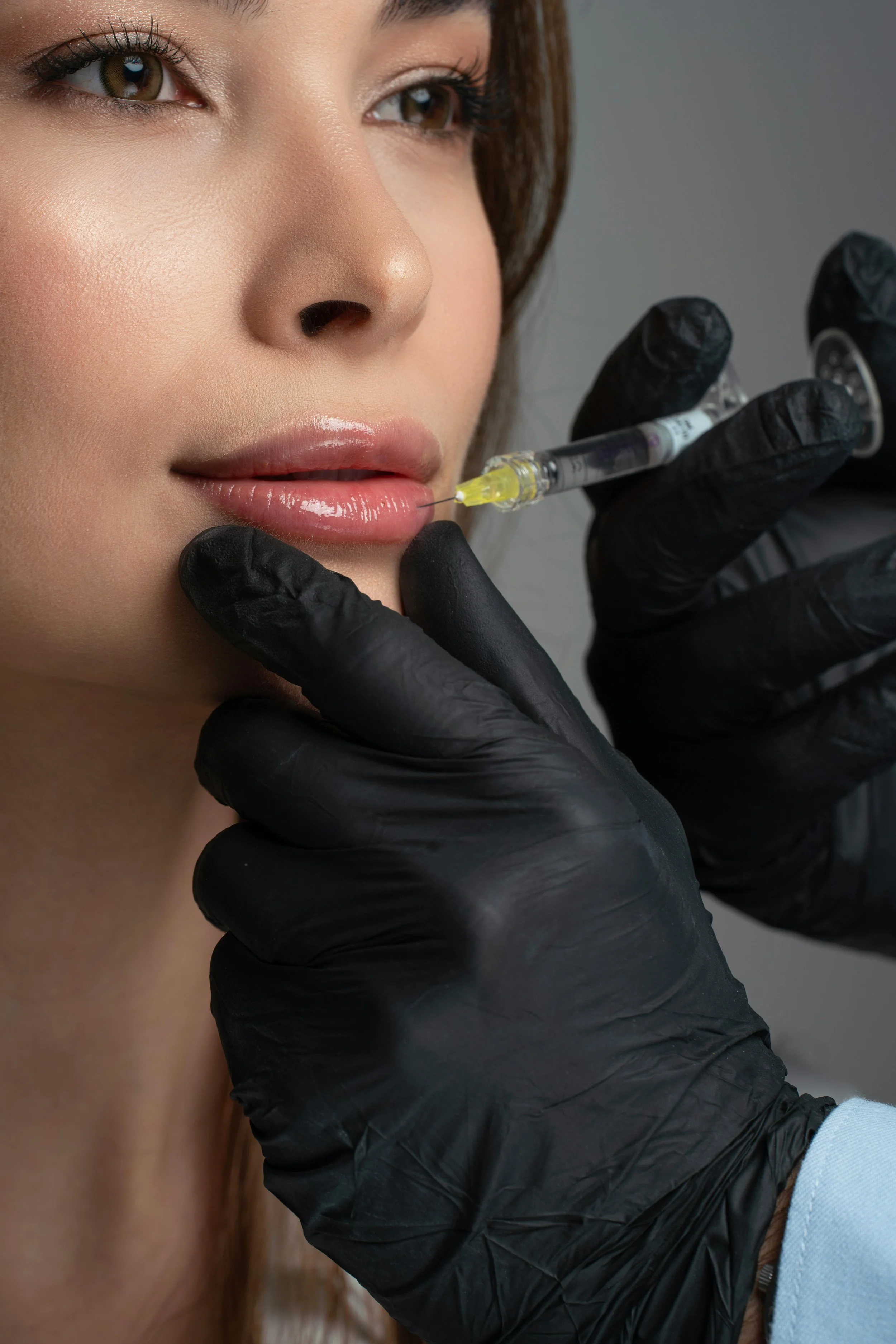 Lip Filler vs. Lip Flip: Which One Is Right for You?