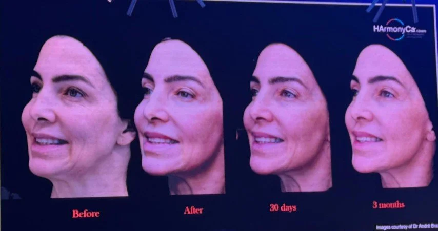 Allergan 3 (Small).jpeg