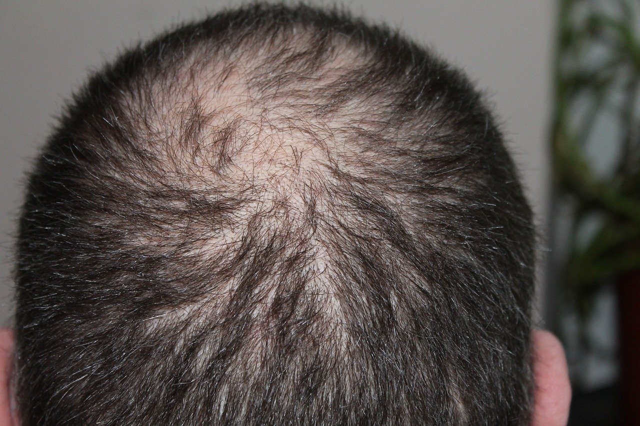 hair-248049_1280.jpg