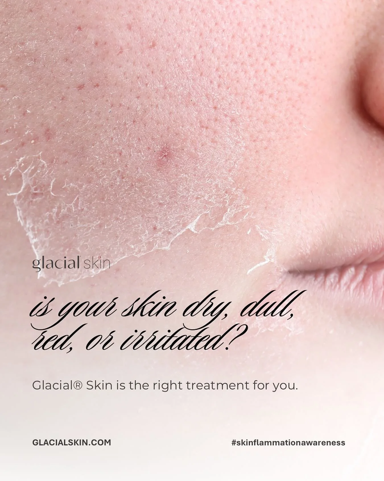 #skinflammation 🧊🧊🧊

SAY BYE TO DRY, DULL, RED, IRRITATED skin!!!