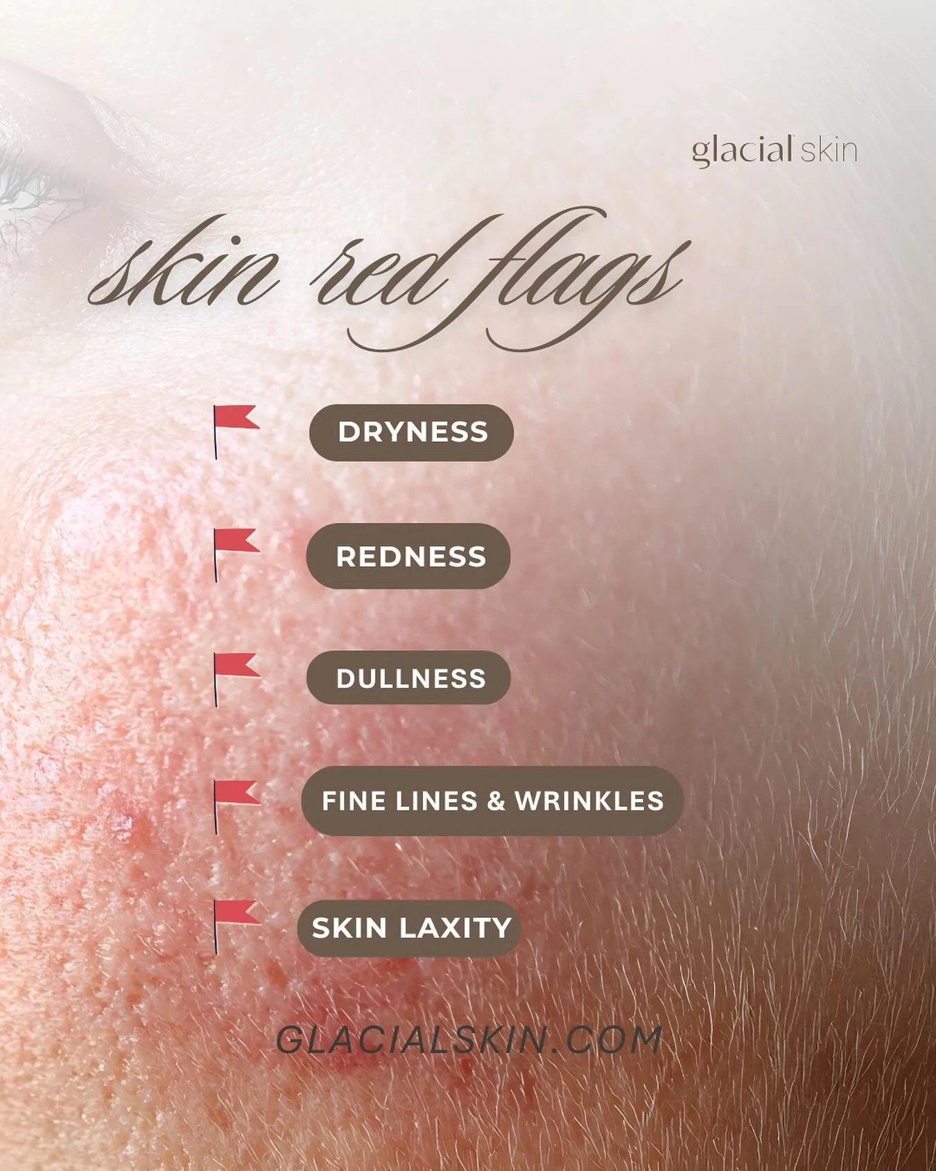 #skinflammation 

SKIN RED FLAGS 🚩 

Do experience any of these? 

The Glacial Skin Facial is perfect for you! 
CALM, COOL &amp; RESTORE 

Book your appointment today! LINK IN BIO