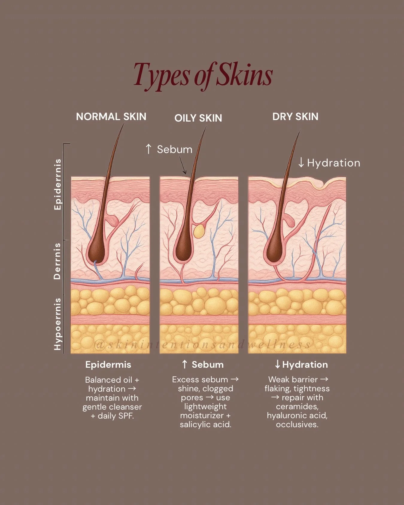 What I hear often is, &ldquo;I have dry skin, so I just need more moisturizer&rdquo; or &ldquo;My skin is oily, so I shouldn&rsquo;t moisturize.&rdquo; 

The truth? Healthy skin starts with understanding what your skin is naturally designed to do.

?