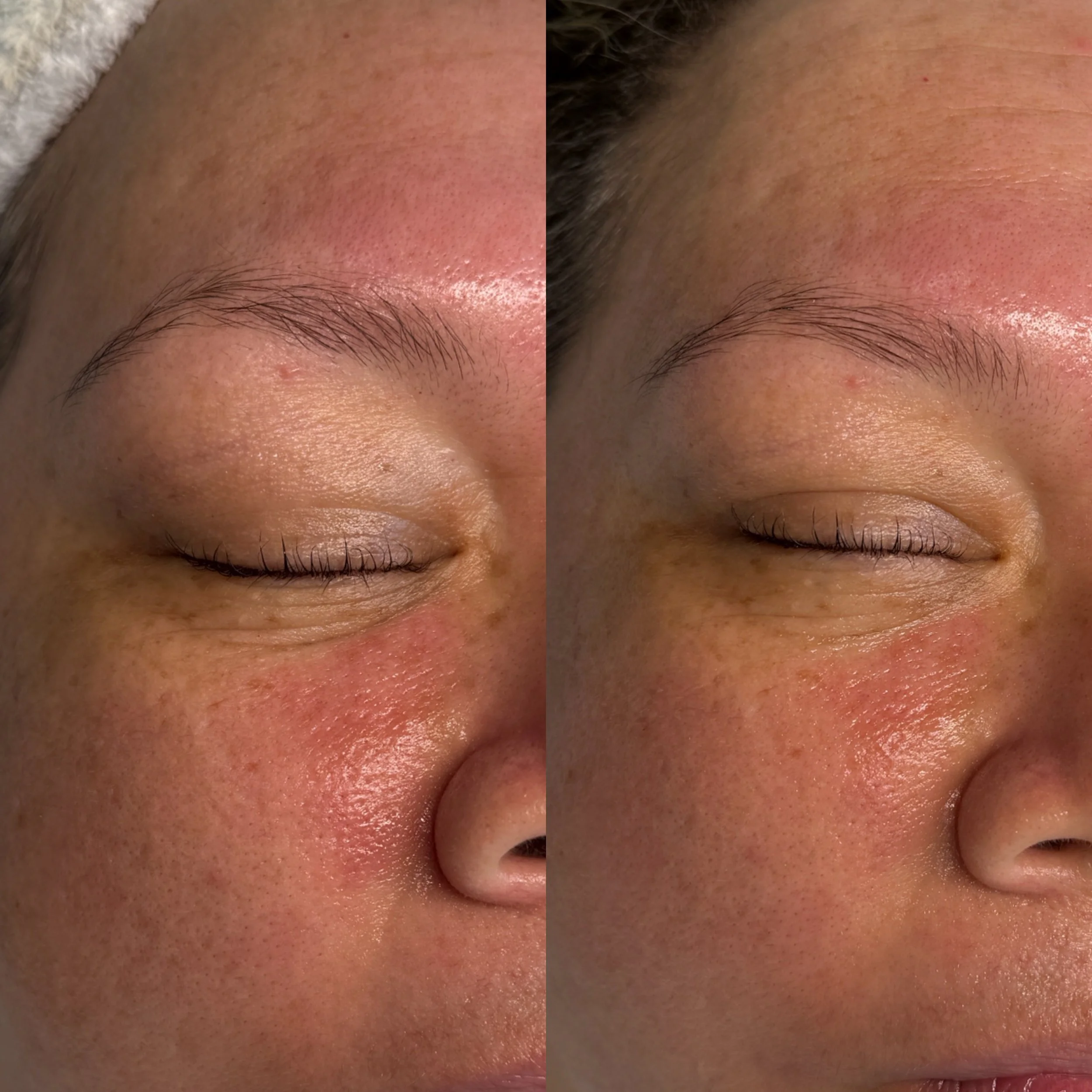 glacial skin facial in kaimuki skin intentions and wellness