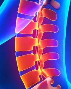 Facet Syndrome and Facet arthropathy – How our Geelong Chiropractors can help