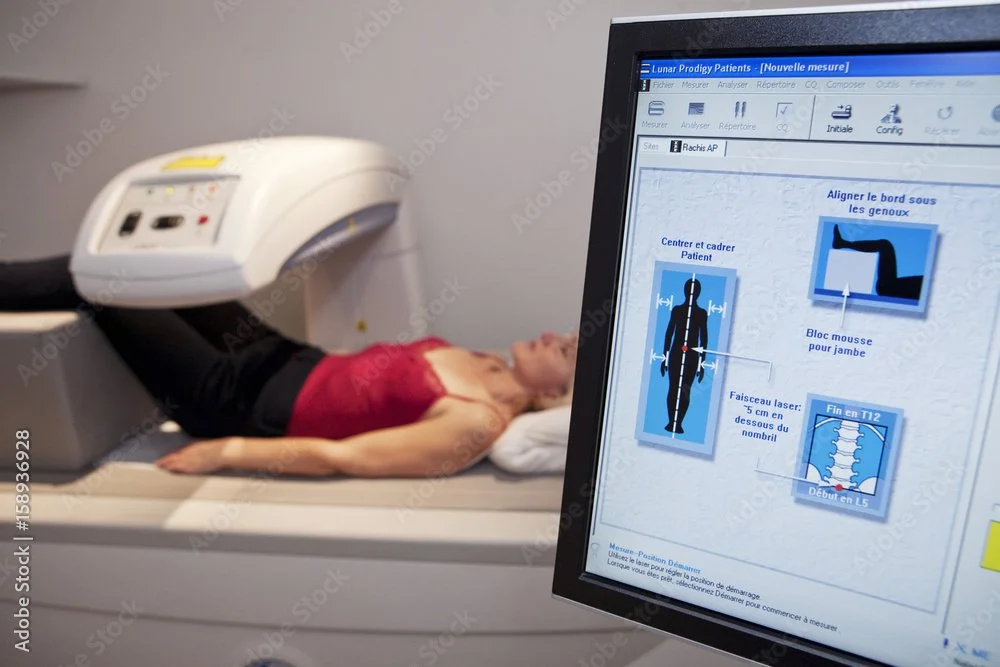 A woman is lying on a medical scan table with her legs extended, undergoing a medical procedure, while a computer monitor displays measurements and instructions for the procedure.