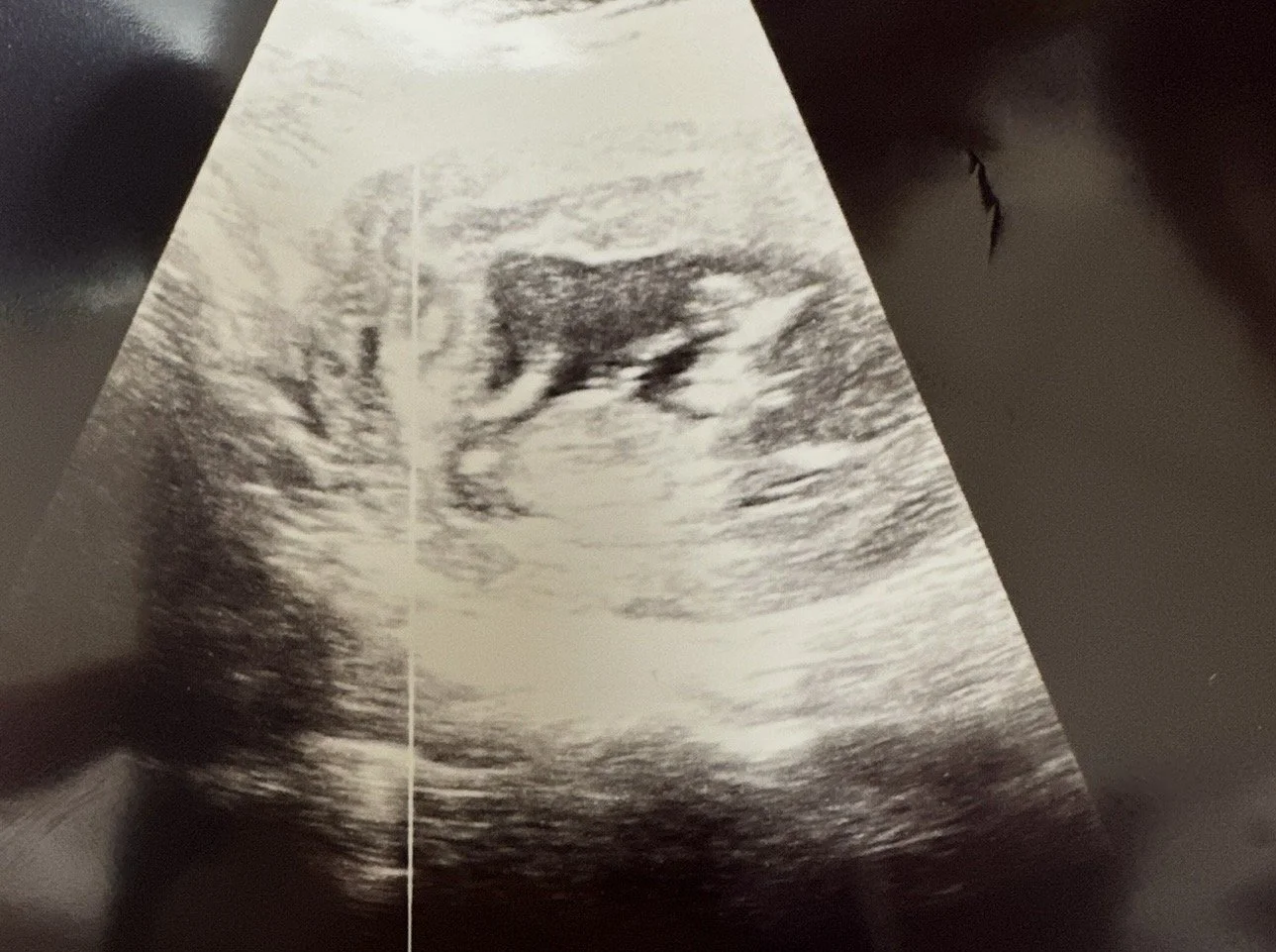 Tyson Joseph Mona  
February 15, 2025 -  
February 15, 2025