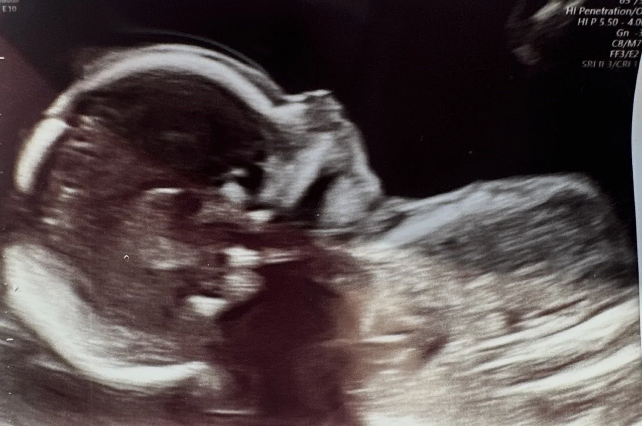 Asher Denison Mona  
May 15, 2026 -  
May 15, 2026