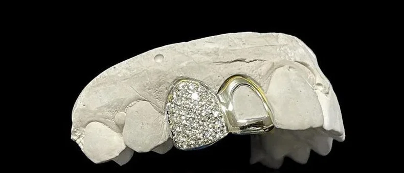 1 Silver Cap w/ Full Moissanite + 1 Window