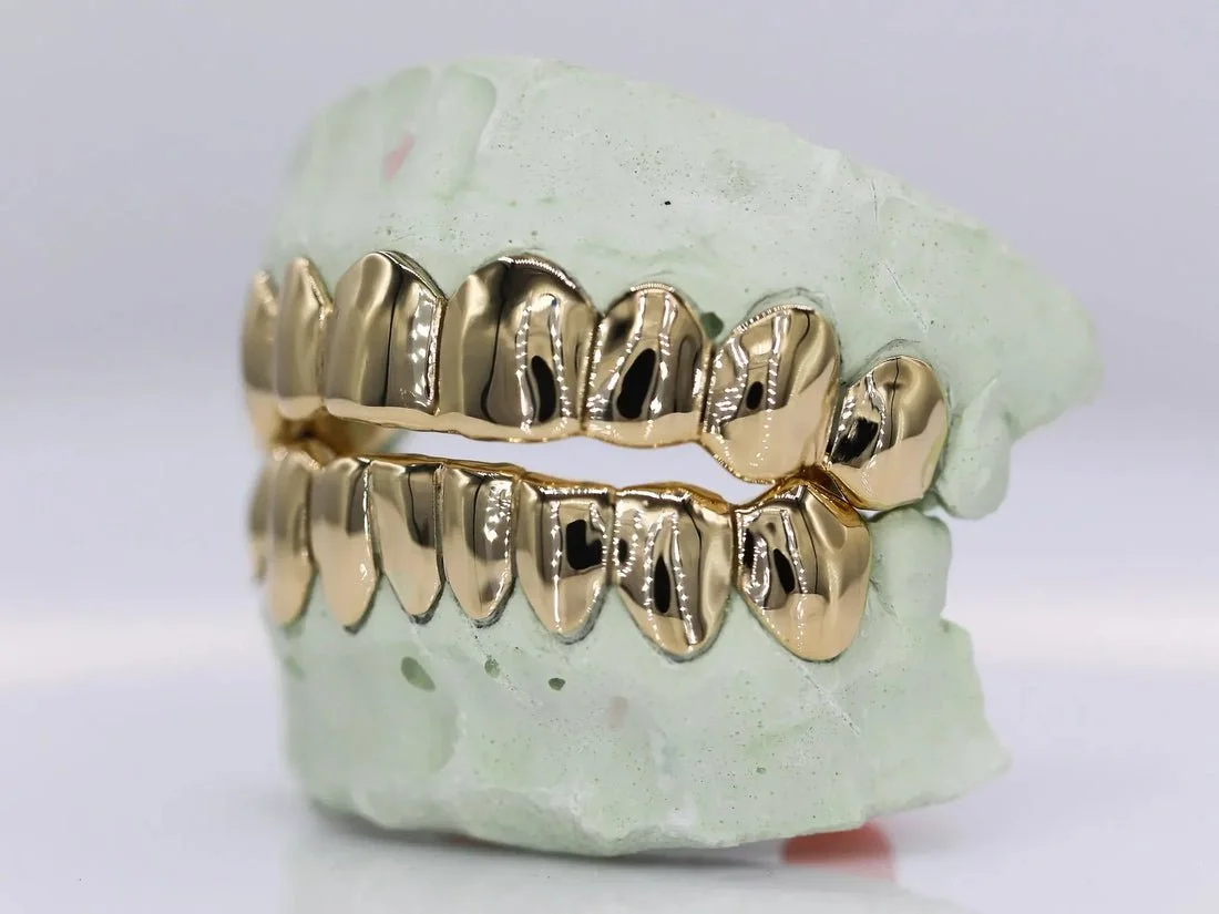 solidgoldgrillz5.jpeg