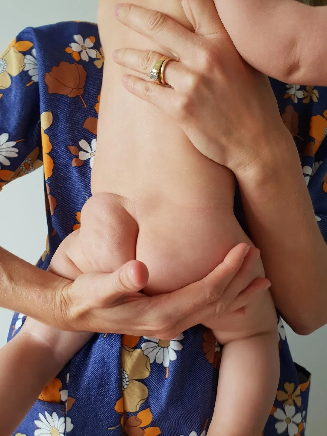 A person with a wedding ring holding a baby's bottom, with a floral dress visible.