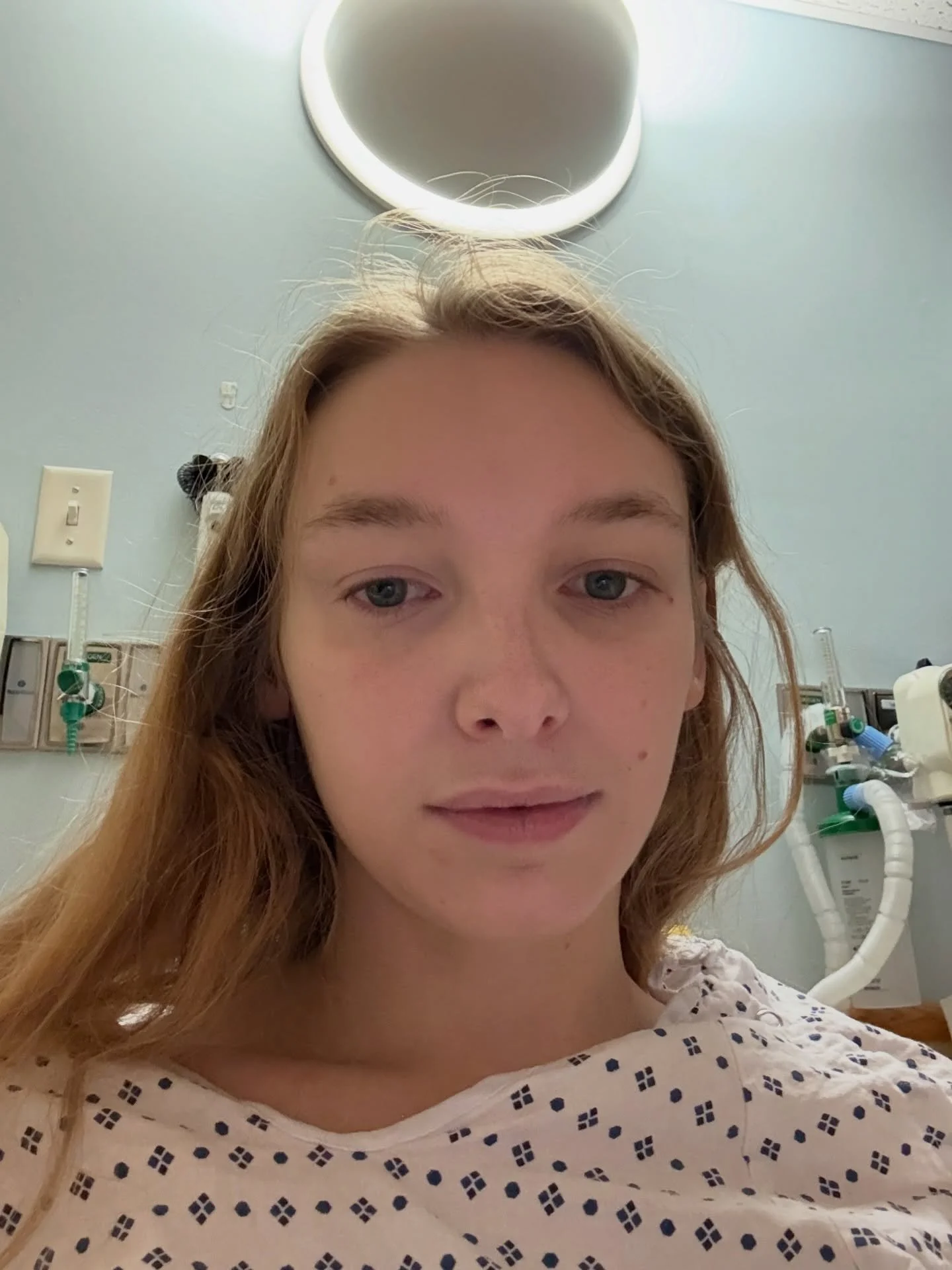 Over the past six weeks, I have been healing from Facial Feminization Surgery. It&rsquo;s been a ride! From having a very restricted diet and dealing with the insecurity of being so swollen and not feeling like I look like myself but kinda monster-is