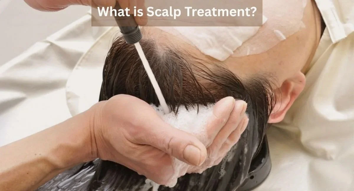 What is Scalp Treatment?