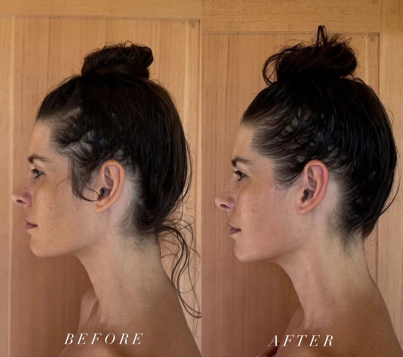 Sculptural face lifting results showing facial contouring and lymphatic drainage benefits