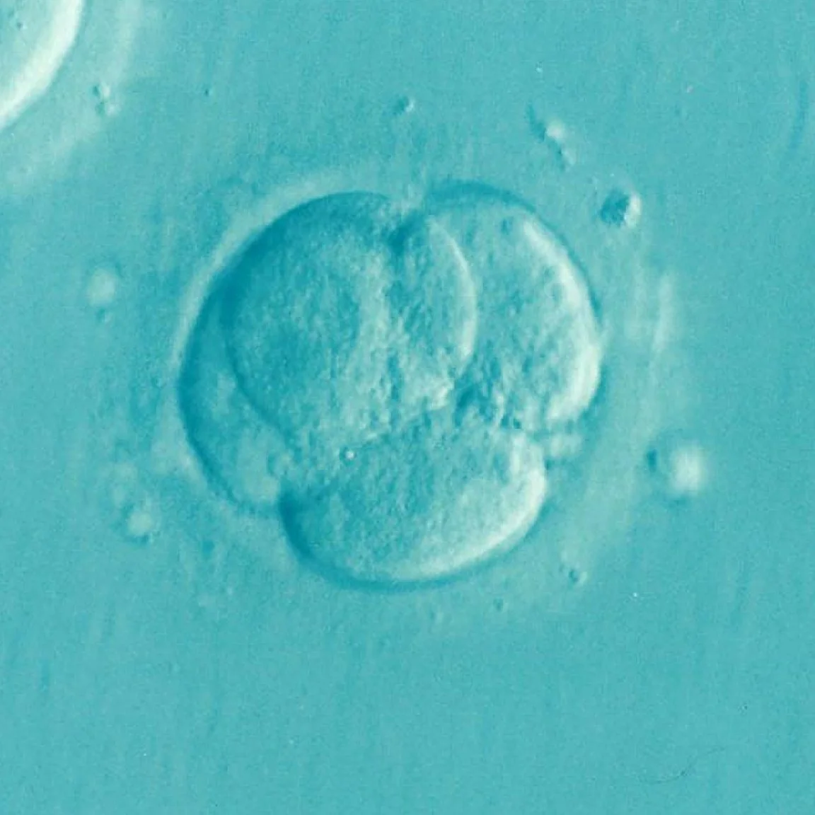 Blastocyst forming after successful IVF cycle