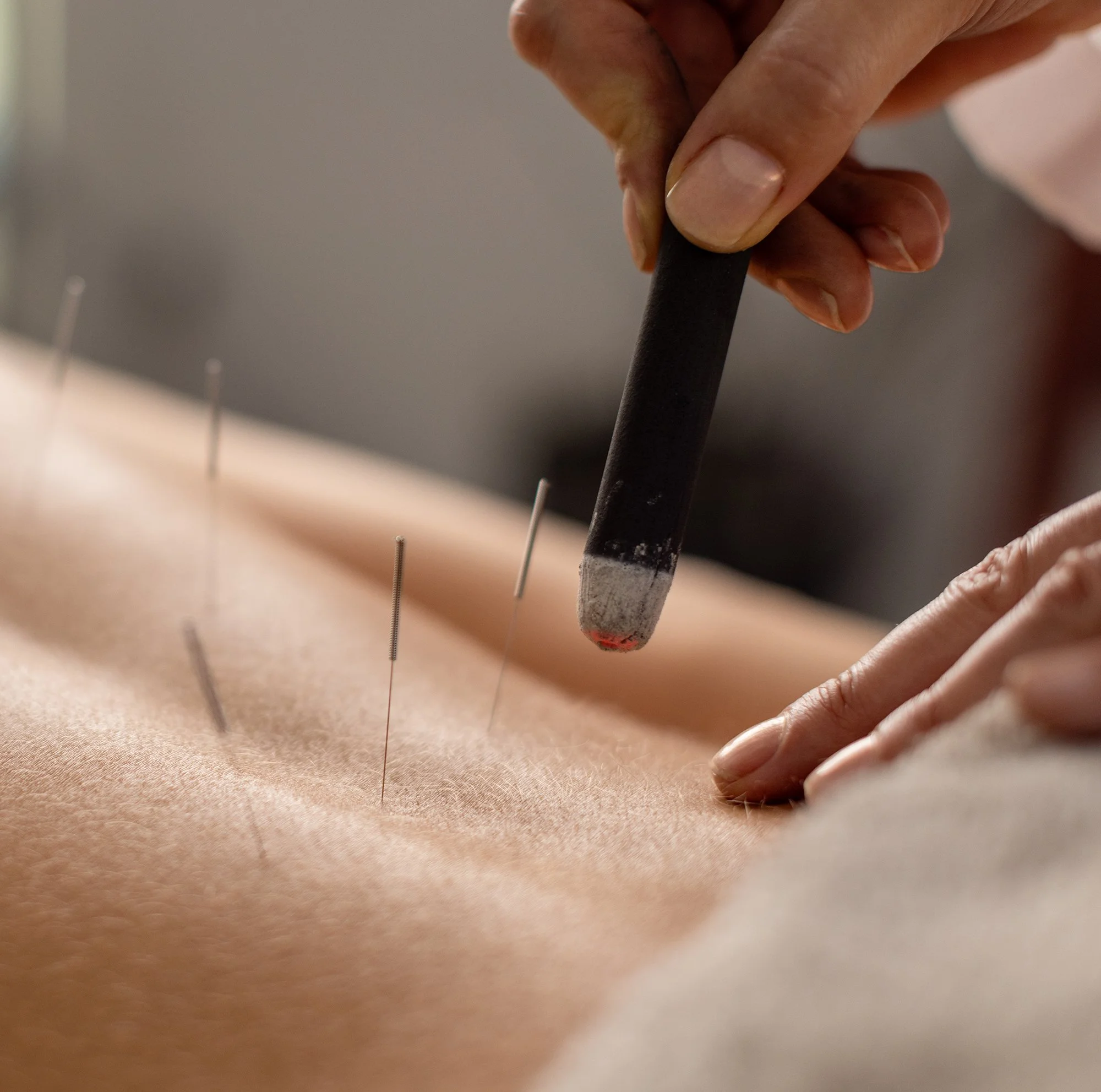 Moxibustion on the low back for fertility enhancement