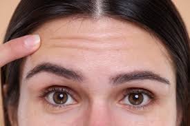 forehead.jpg