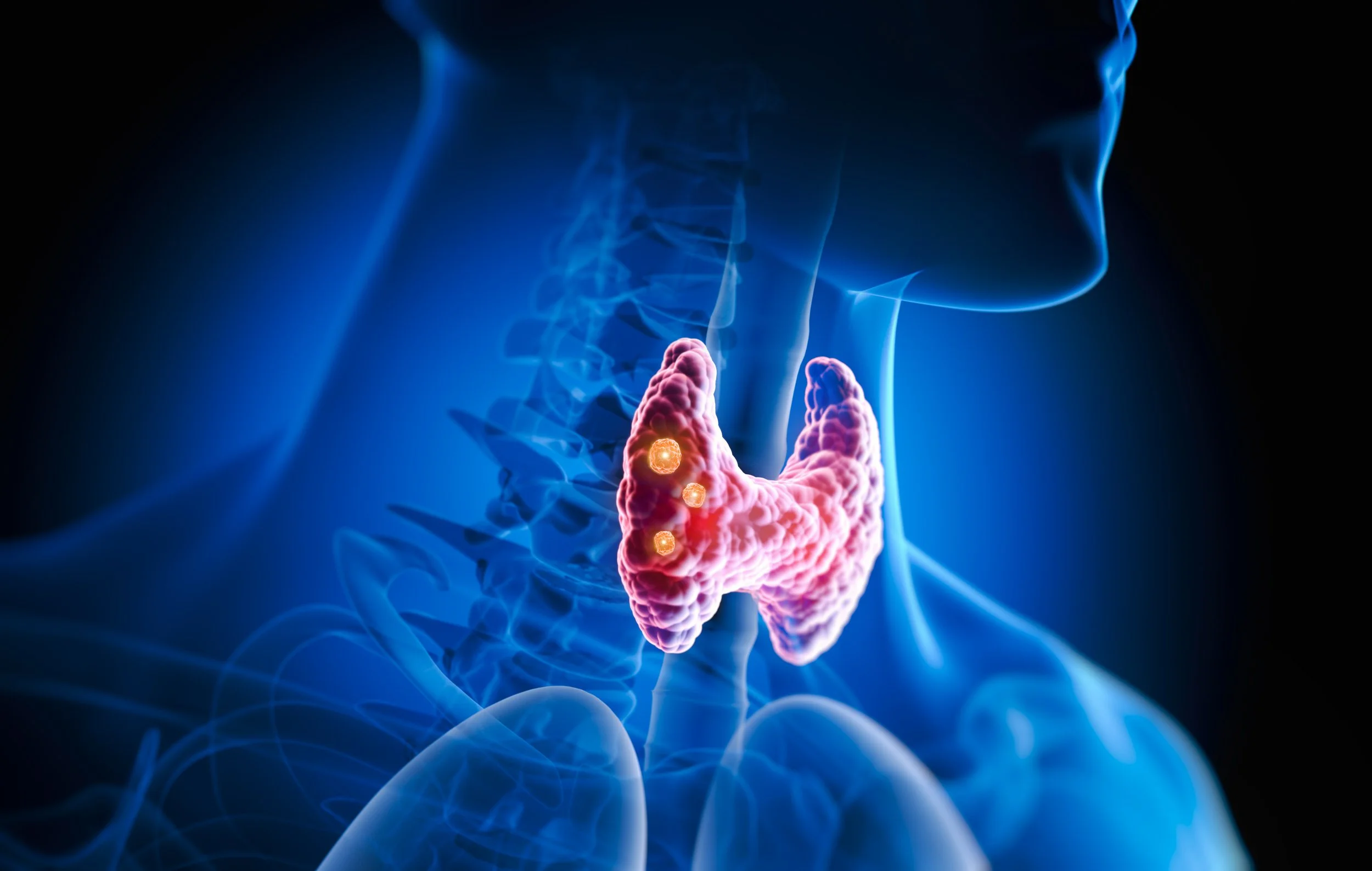 Thyroid.jpg