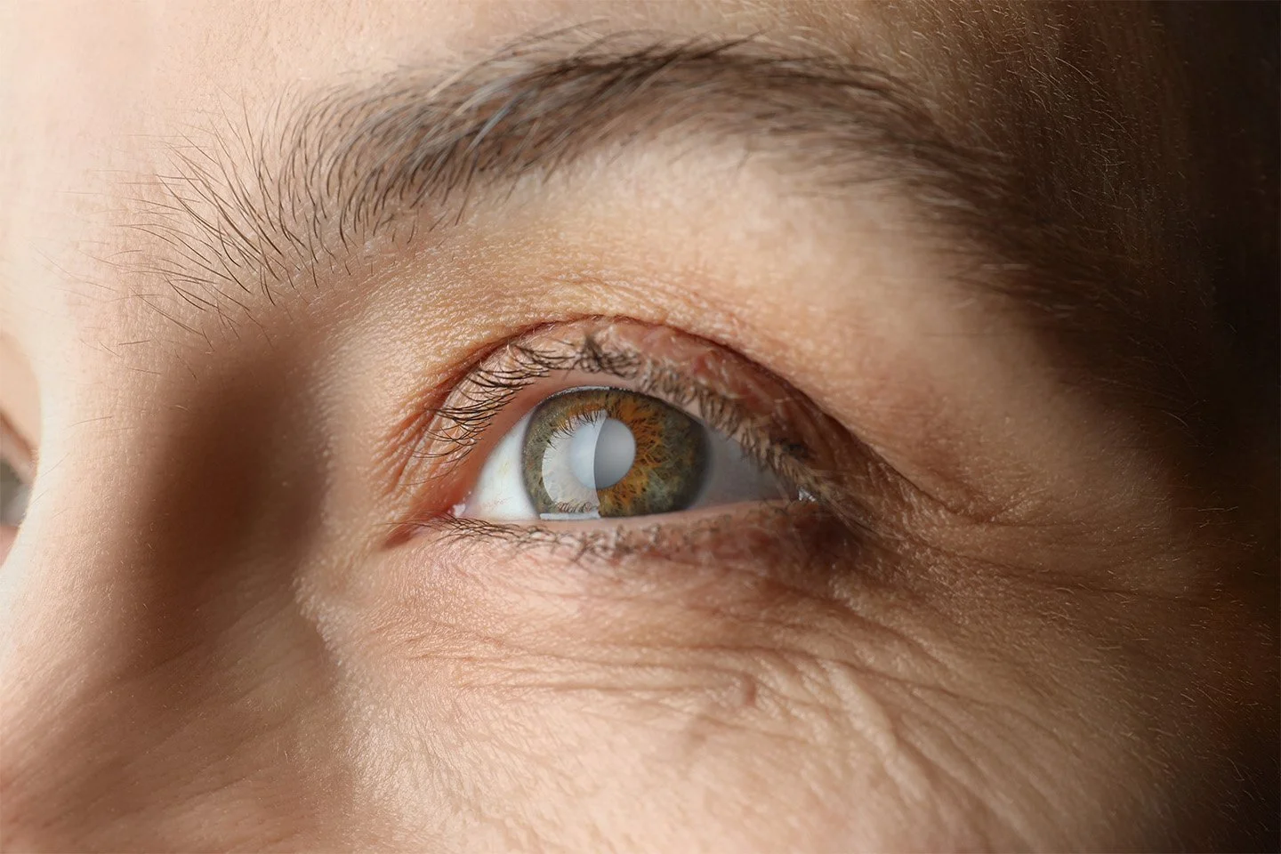 Close-up of cataract eye surgery with surgical instruments and a medical device administering treatment.