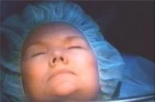 vikiben_cancer_3_31_00_3.jpg