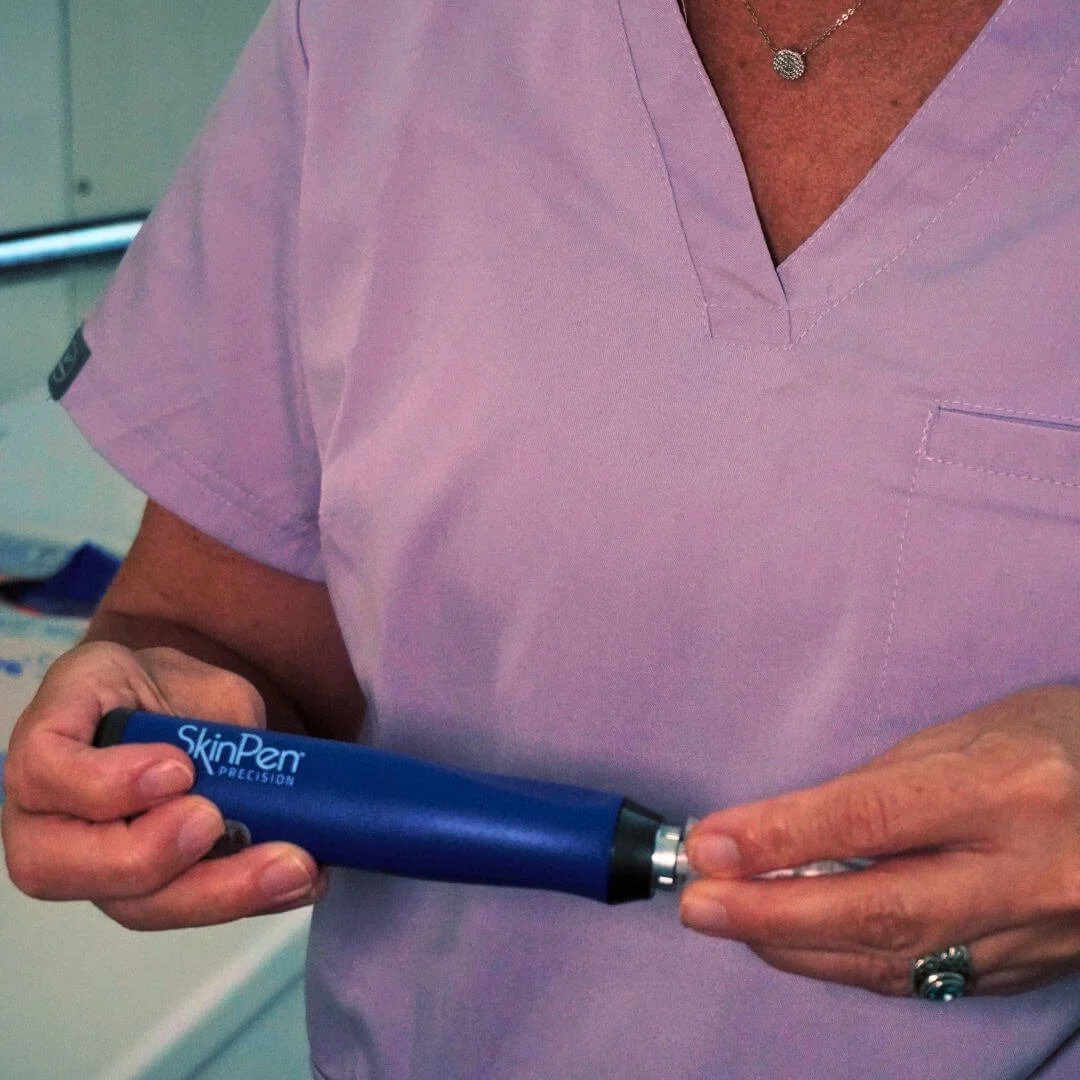 skinpen-3.jpg