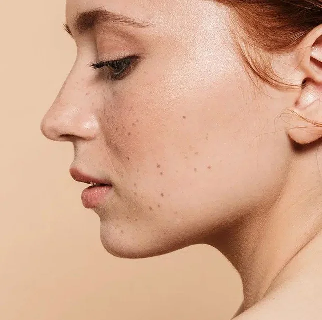 Fat dissolving: silhouette sculpting