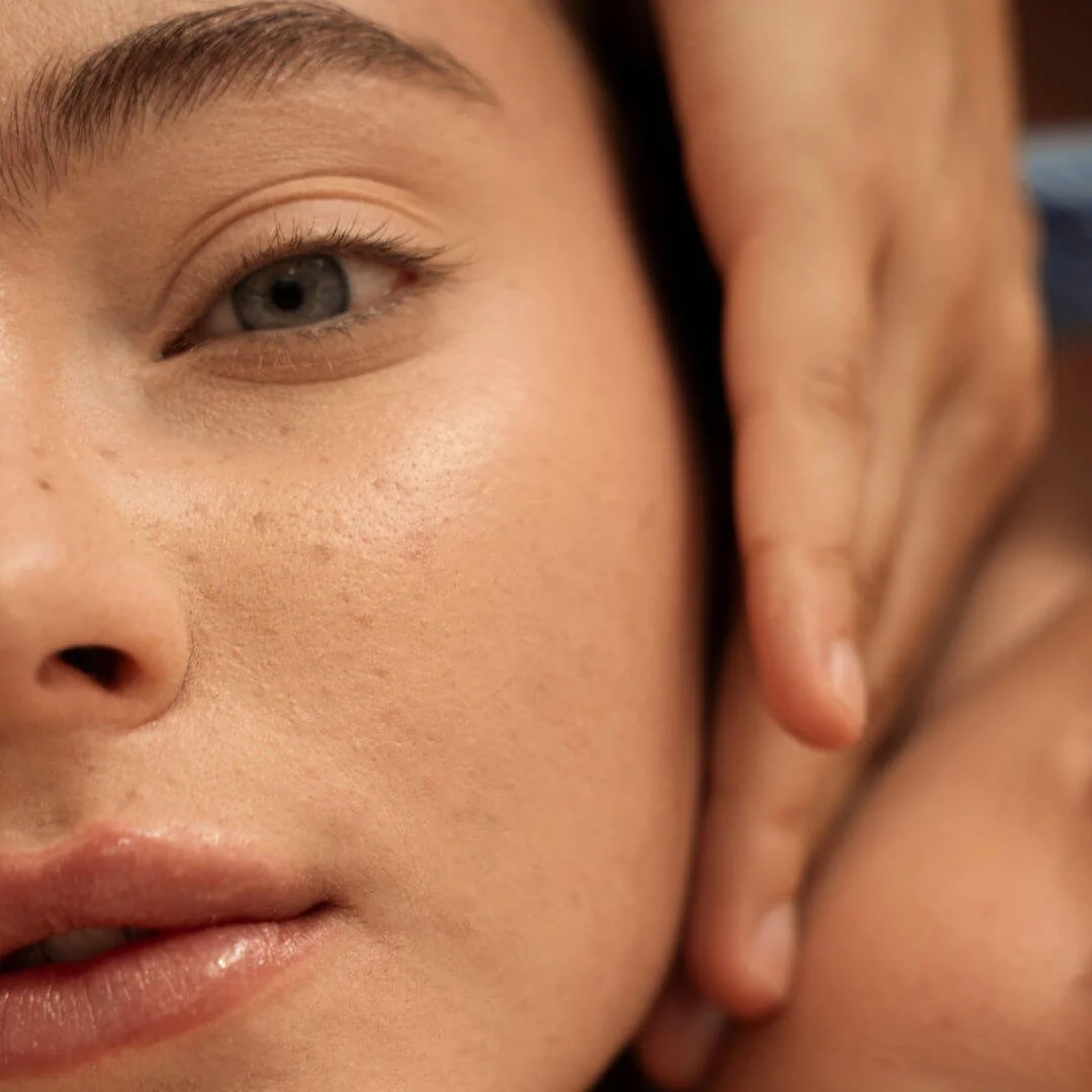 SQT: bio-microneedling & natural skin renewal