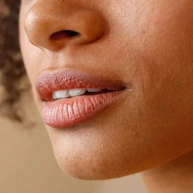 Close-up of a person’s lower face, illustrating facial areas considered during a symmetry and volume-loss consultation.