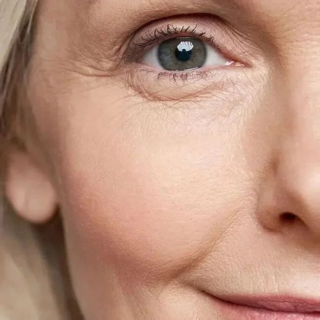 Wrinkle relaxers: refresh your expression