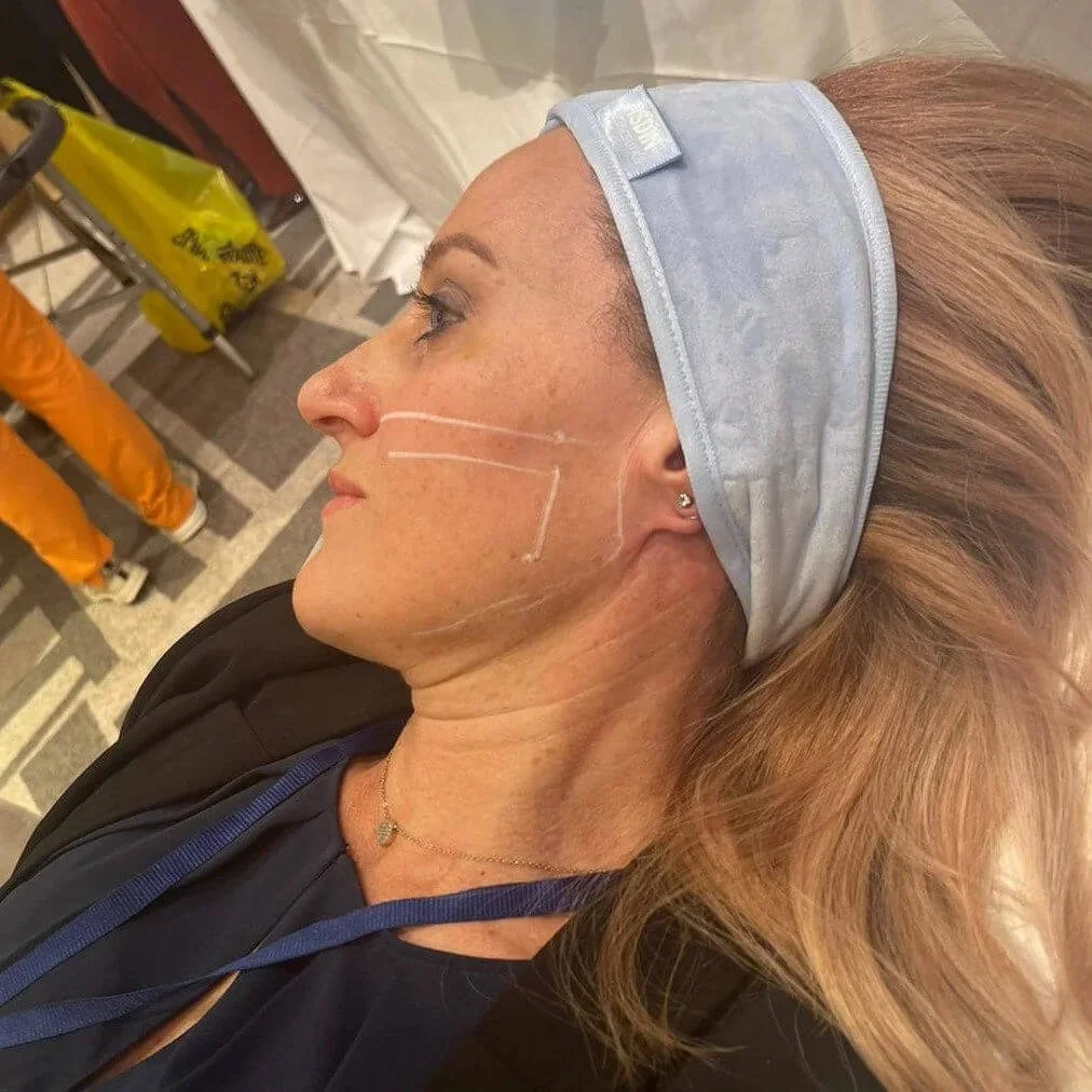 Registered Nurse Jolieta participating in professional facial anatomy and aesthetics training.
