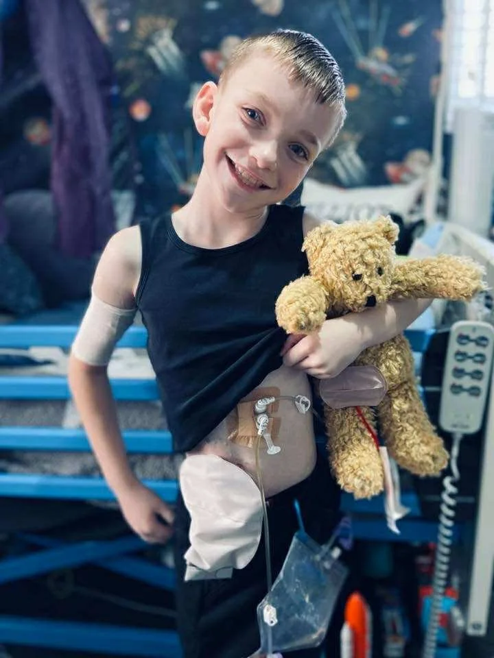 A young boy smiling in a hospital room, holding a teddy bear and showing a prosthetic limb on his stomach.