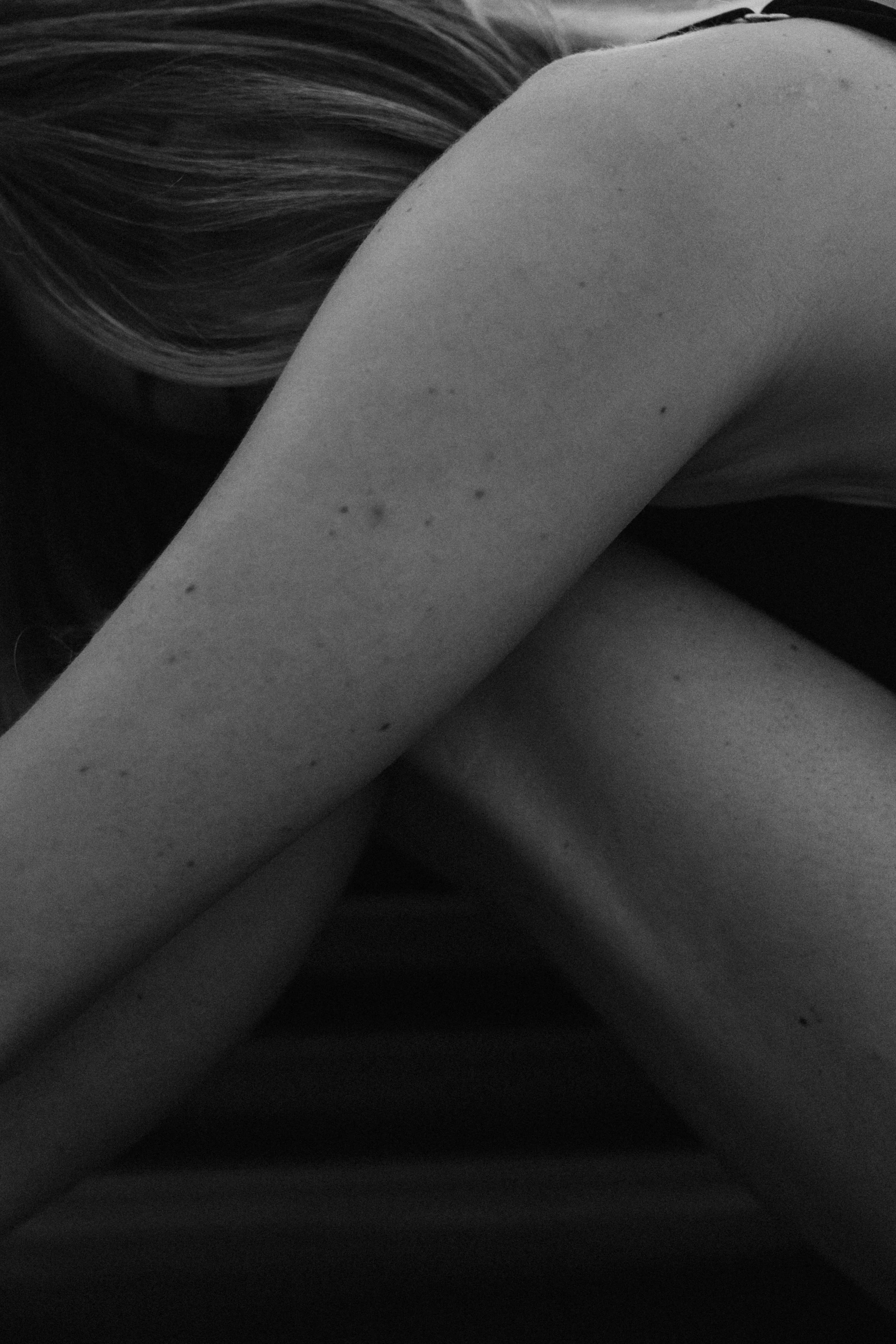 Close-up black and white photograph of a person's shoulder and upper arm, with a focus on the skin's texture and natural details.