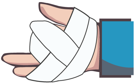 Illustration d'une main enveloppée de bandages suite à la perte de 2 doigts.