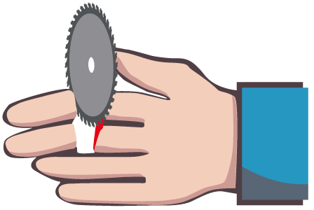 Illustration de 2 doigts sectionnés par une petite scie circulaire utilisée pour couper du bois.