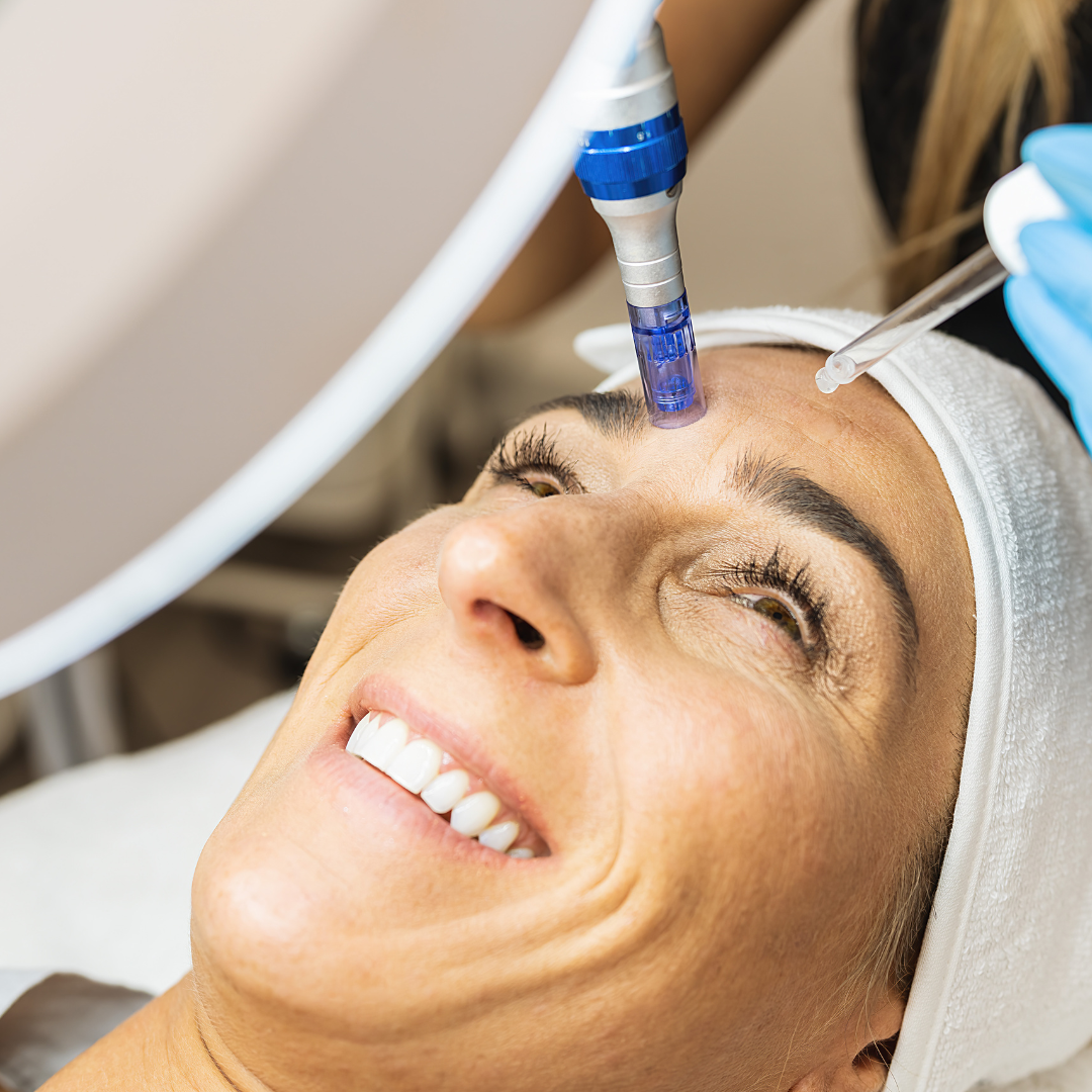 Medspa in Chicago, IL, 60608 | Microneedling with PRP Near Me