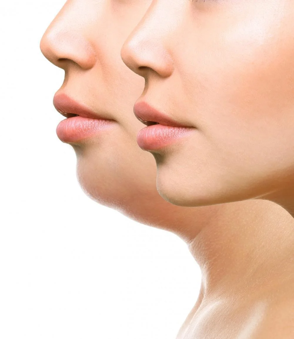 Close-up side profile of two women's faces with smooth skin and neutral expressions, showing their noses, lips, and jawlines.