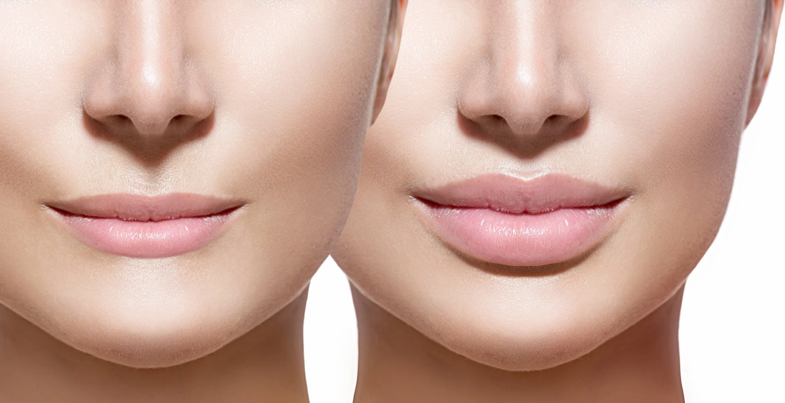 Close-up of two women's faces comparing their lips; one has slightly fuller, glossed lips, the other has thinner, matte lips.