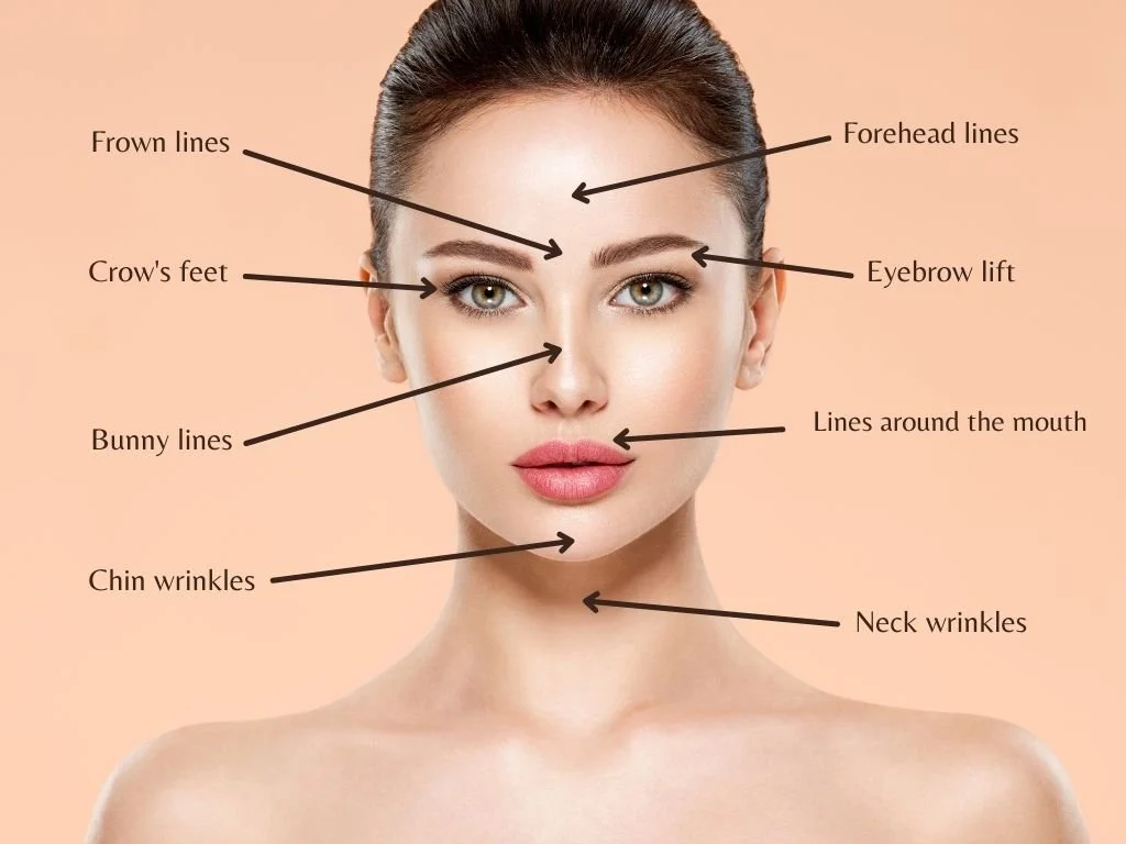 A woman with labeled facial features indicating common areas of concern in anti-aging, including forehead lines, eyebrow lift, lines around the mouth, neck wrinkles, chin wrinkles, bunny lines, crow's feet, and frown lines.
