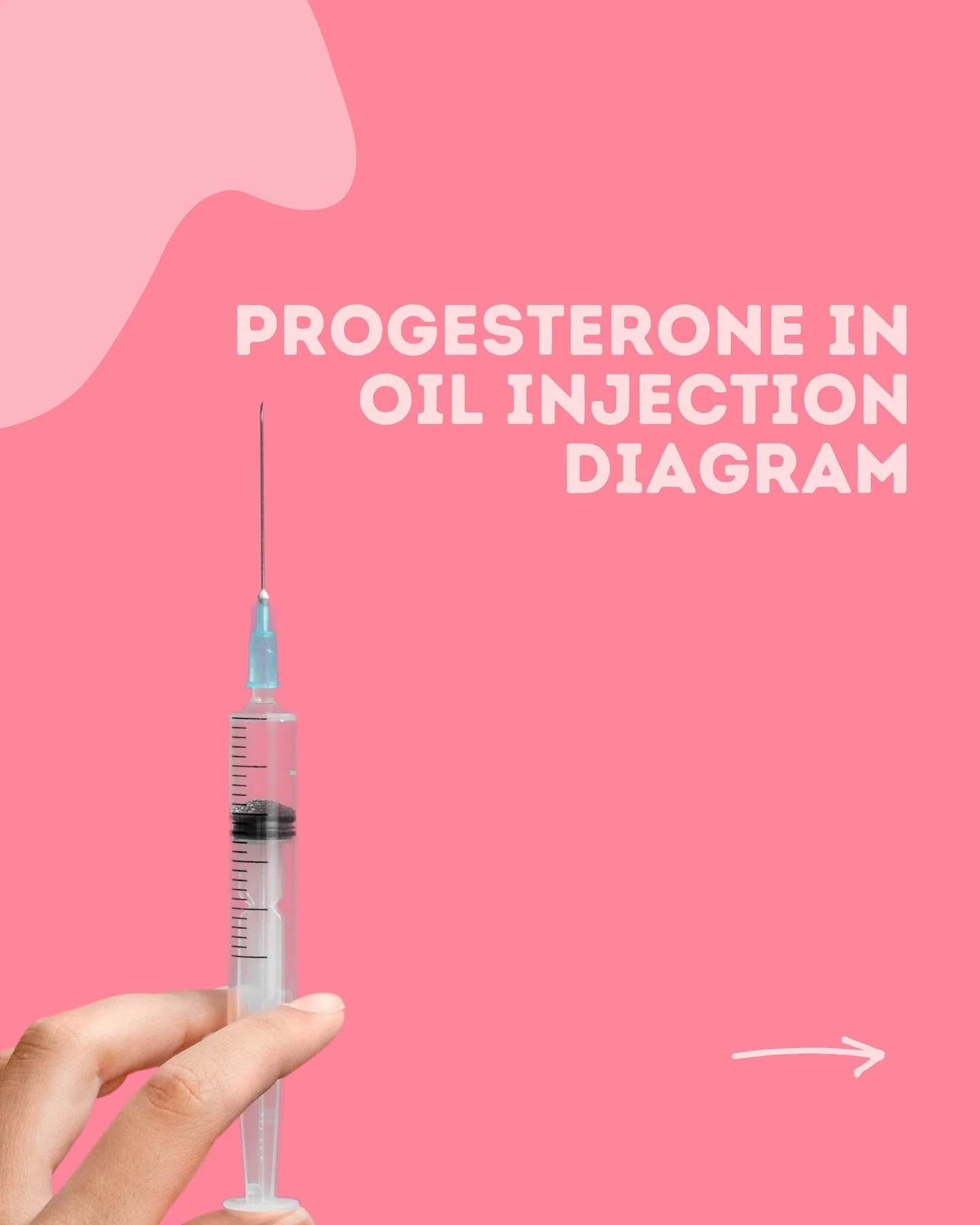 I strongly suggest asking your IVF team to show you how to locate the best injection sites on YOUR body.
The diagrams and videos that are available are a helpful guideline but not specific to your unique physique.
Having a nurse show you how to locat