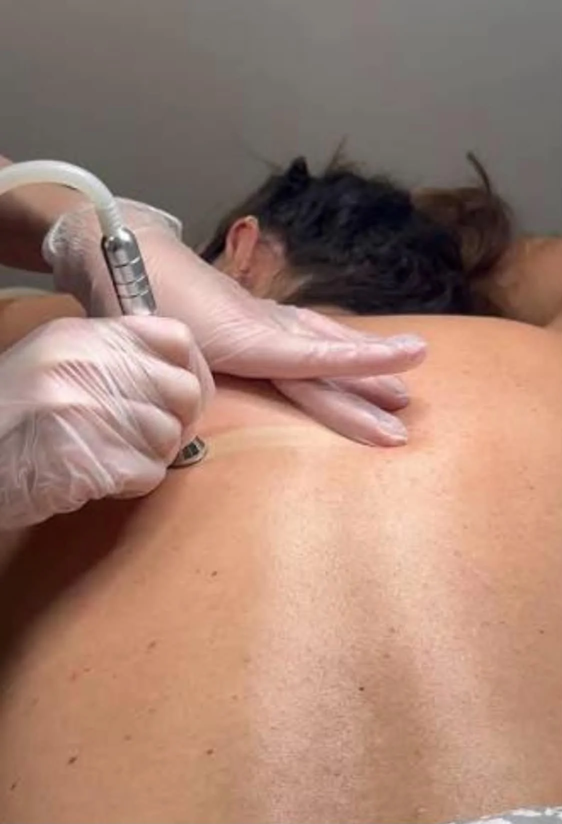 Back JoliPeel
