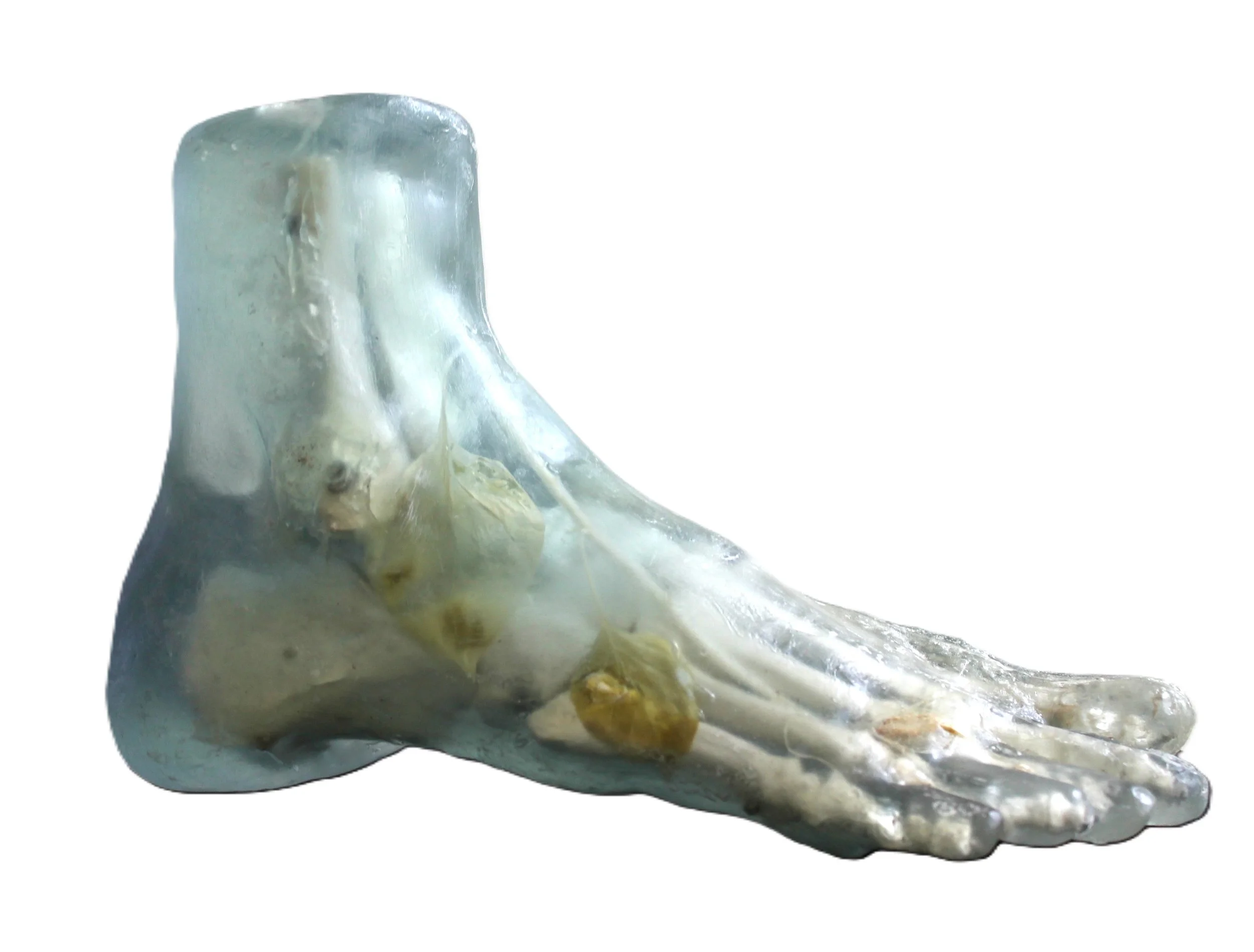 SOLANUM NIGRUM , 2015,
Gießharz, Anatomisches Fußskelett, Schwarzer Nachtschatten , 25 x 13 x 15 cm