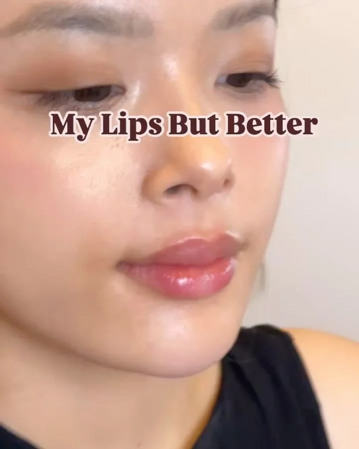 One of the Charm clinic&rsquo;s most popular treatments is MLBB lip augmentation 👄 

For this specific case, we focused on
- more defined Cupid&rsquo;s bow
- symmetrical upper lip
- subtle volume increase at the lower lip

DM us or book online for a