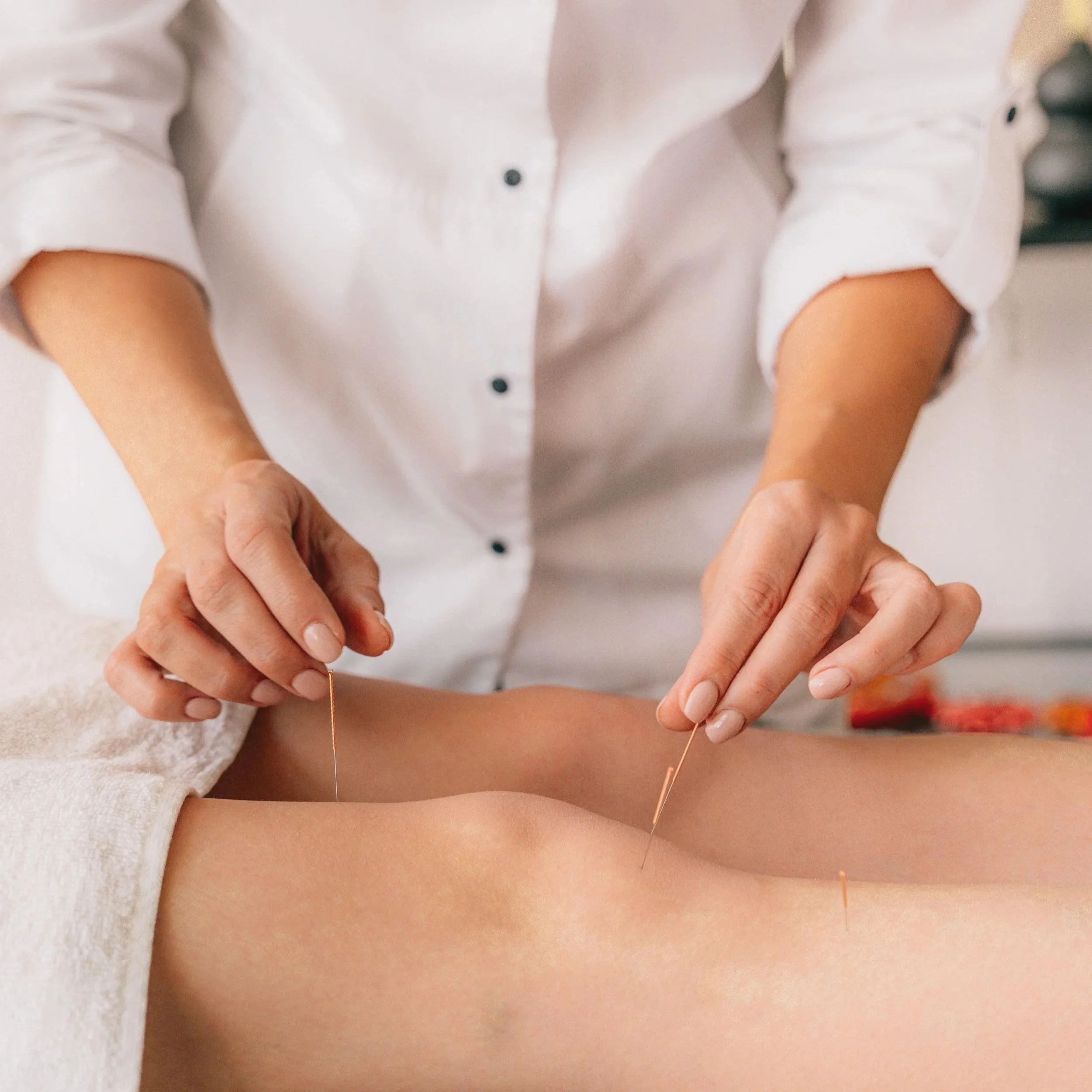 Making the Most of Your Acupuncture Treatment