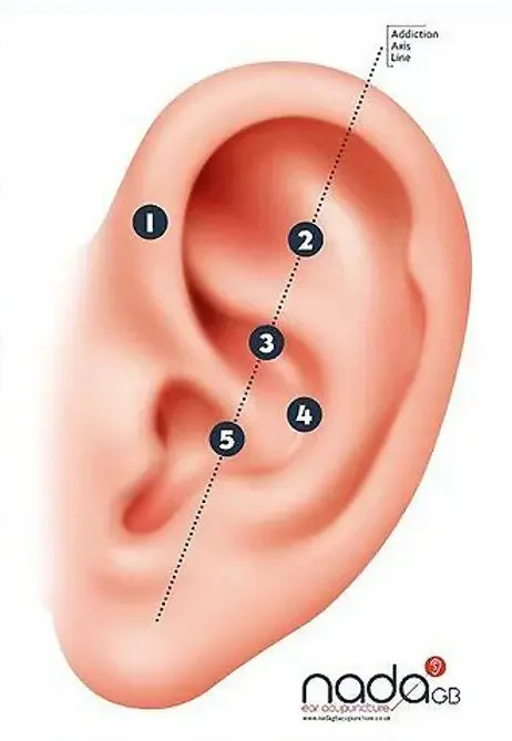 The Nada Auricular Acupuncture protocol offered at NRQi Studio in Winchmore Hill, North London N21.