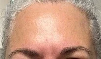 Close-up of a person's forehead and eyebrows with gray hair at the top