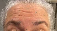 Close-up of a person's forehead and hairline with gray hair.