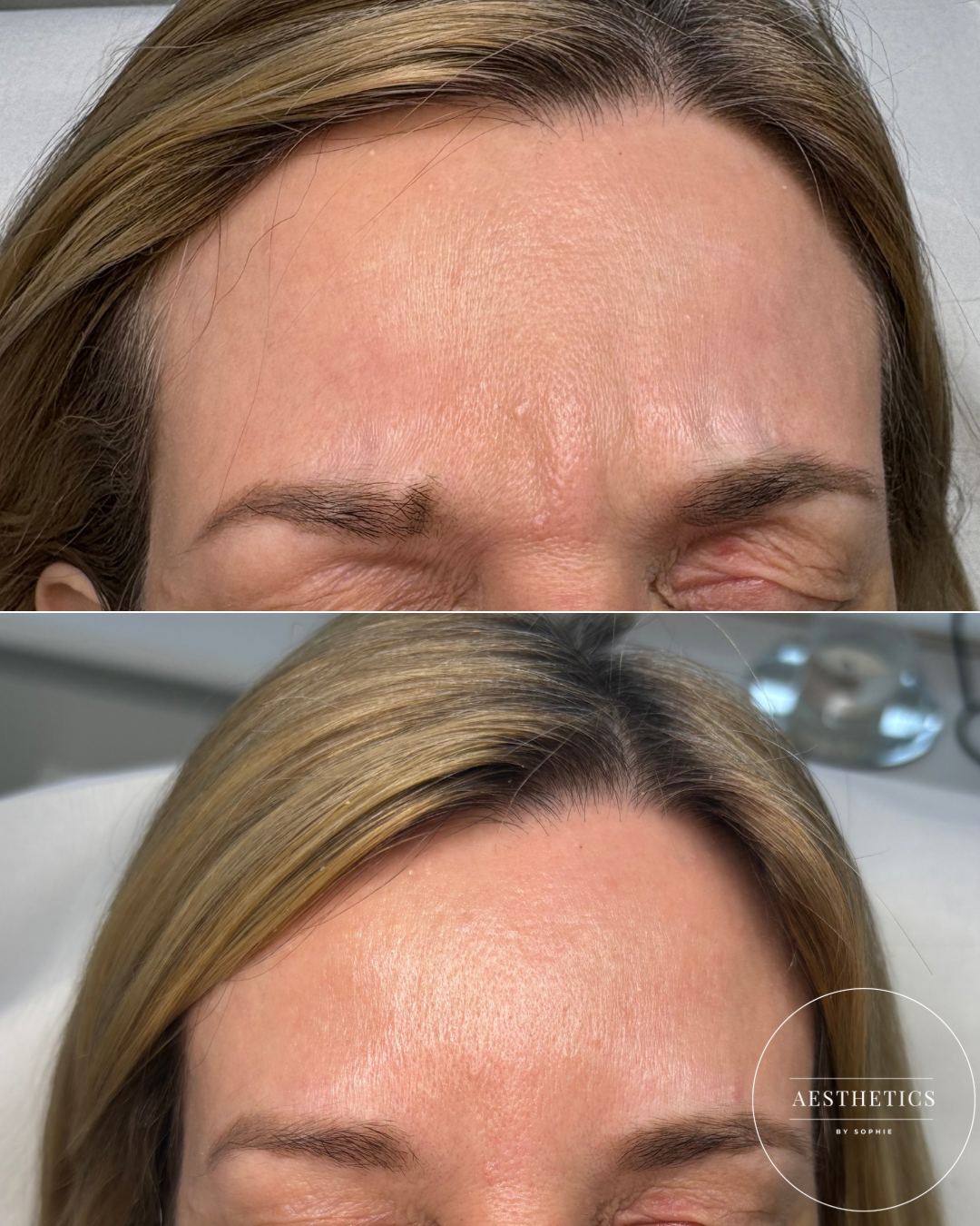 Copy of Before and after Lindsey 2.PNG